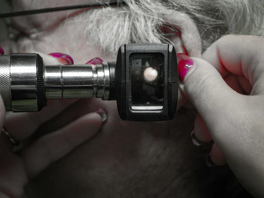 Ear Wax Removal at The Optical Gallery: Affordable, Safe & Professional Service in Twickenham, Chessington & Cheam